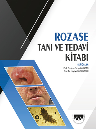 ROZASE TANI VE TEDAVİ KİTABI