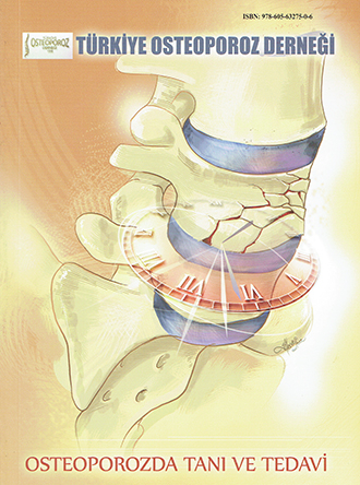 Osteoporozda Tanı ve Tedavi