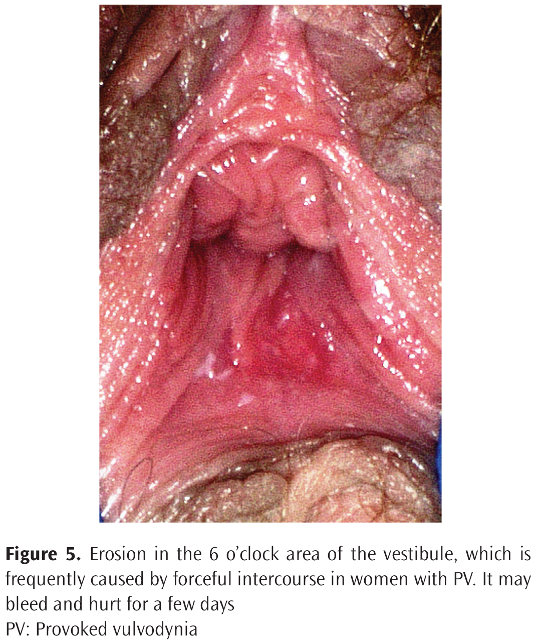 Yalangoch Vasilisa Romanovna Mixaylovaning fotosurati Aishvarya Rai yalangoch Alla Pugacheva jinsiy aloqa