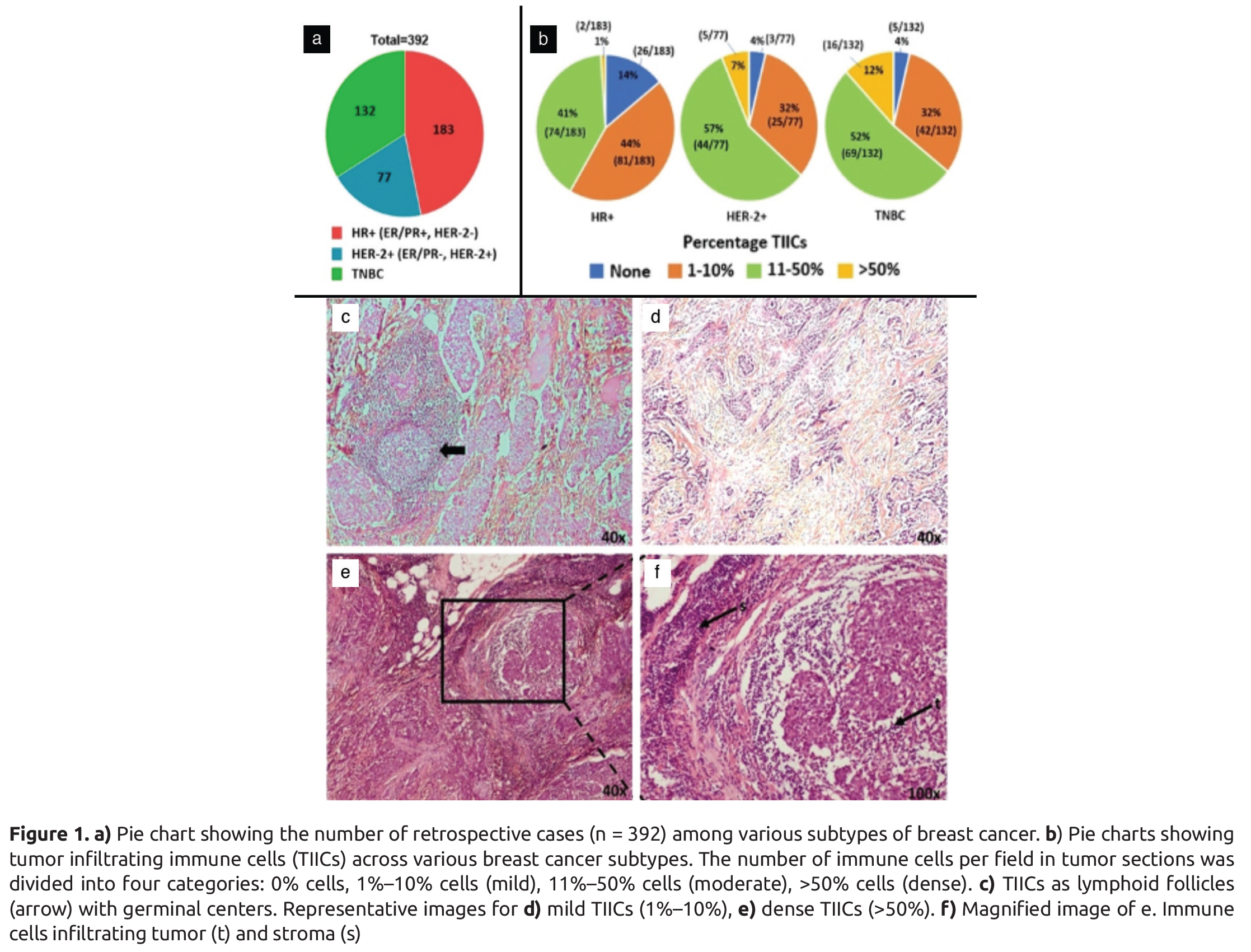 PD-1 and PD-L1 Expression in Indian Women with Breast Cancer - European ...