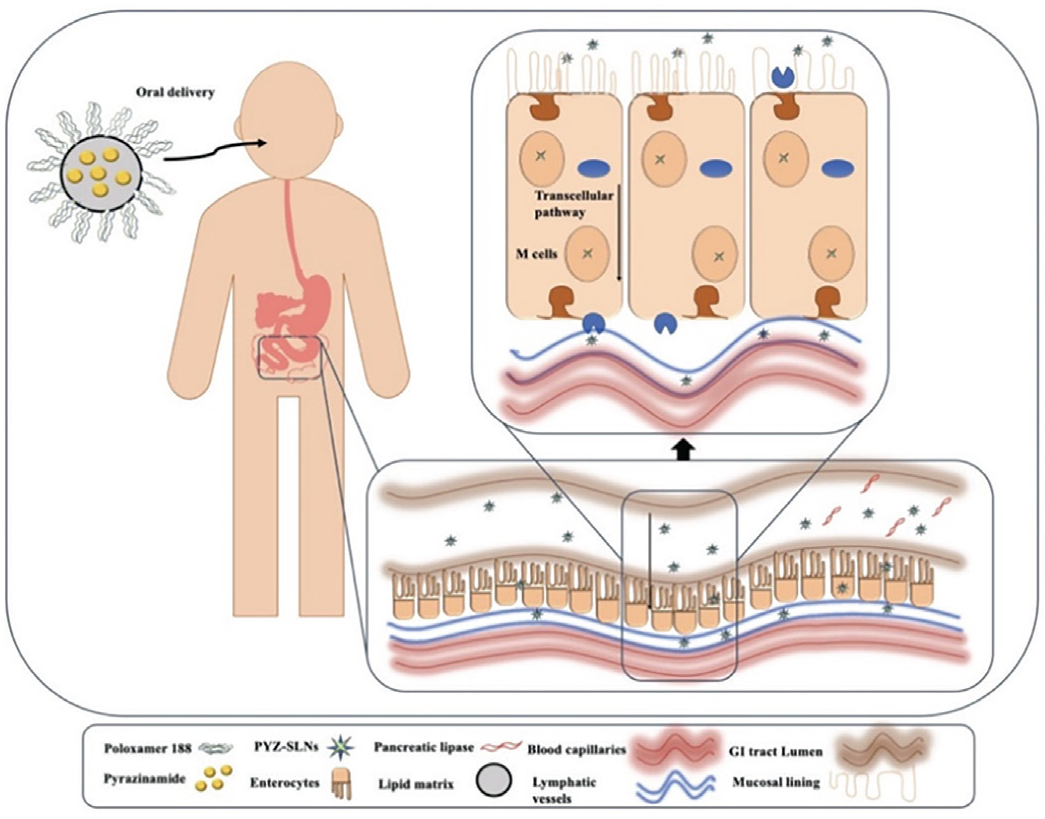 Formulation and Optimization of Pyrazinamide-Loaded Solid Lipid ...