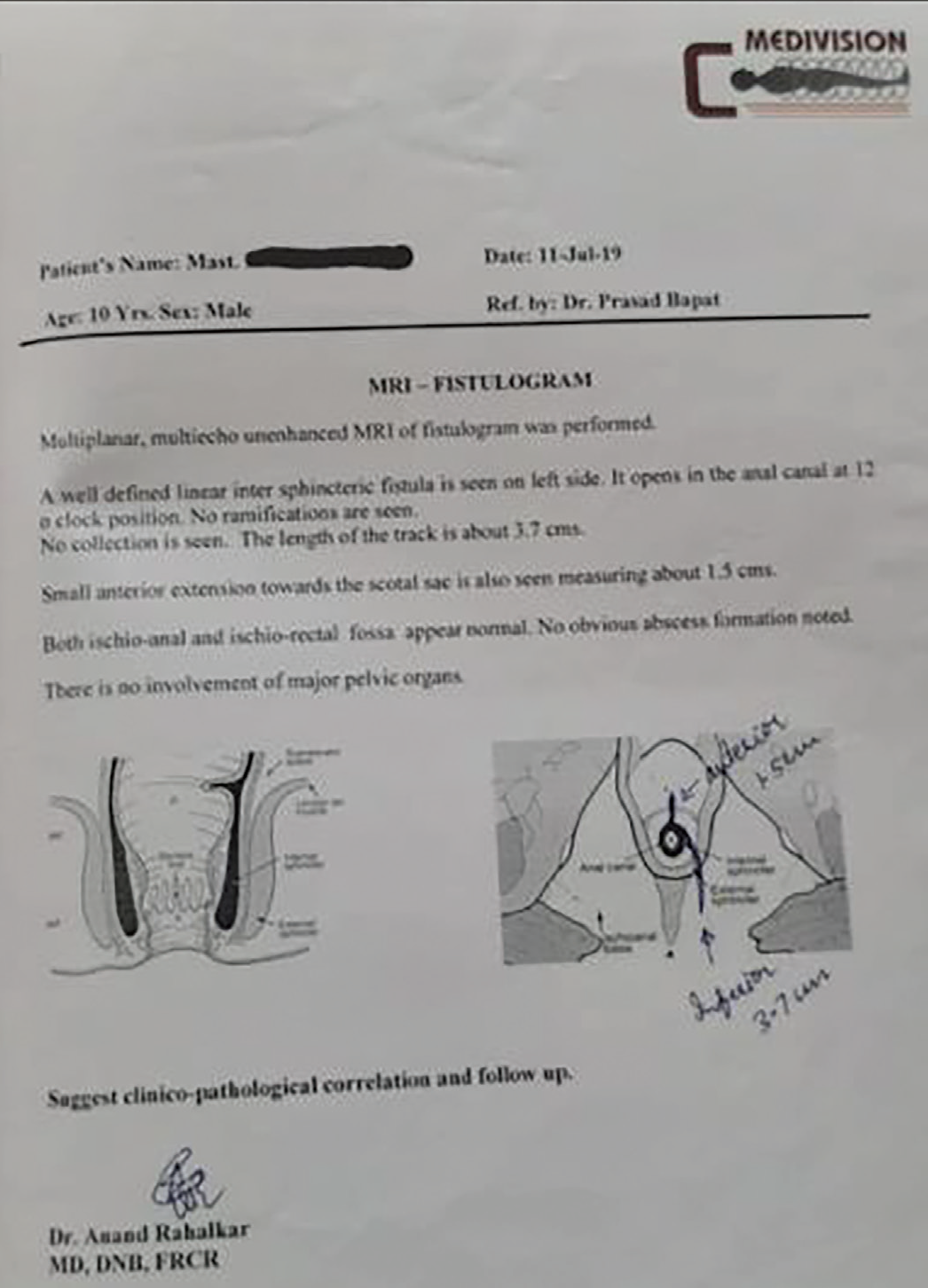 Aleysk porno video va fotosuratlar