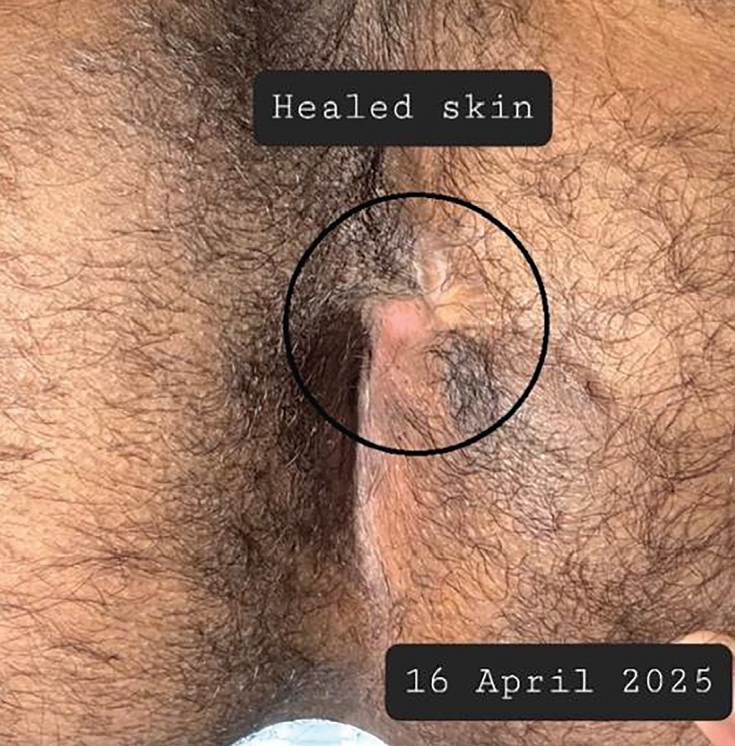 Nina Xartli kunnilingus