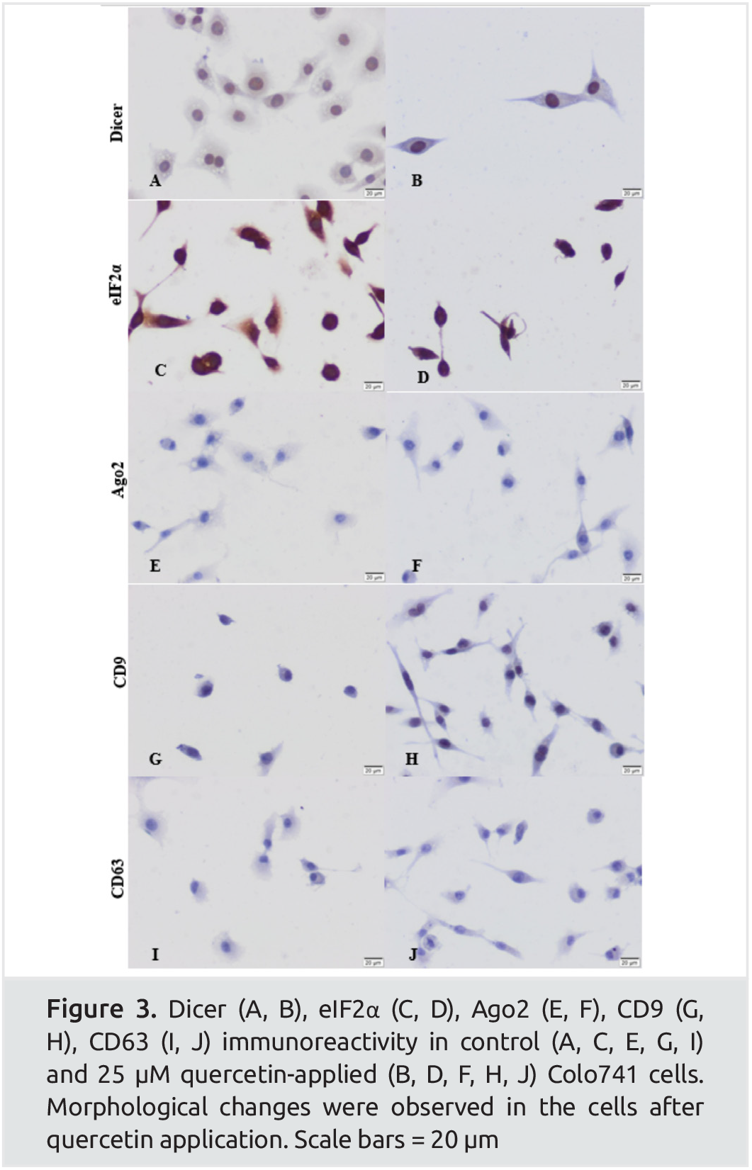 Quercetin Change the Exosome Secretion and Total miRNA Concentration in ...
