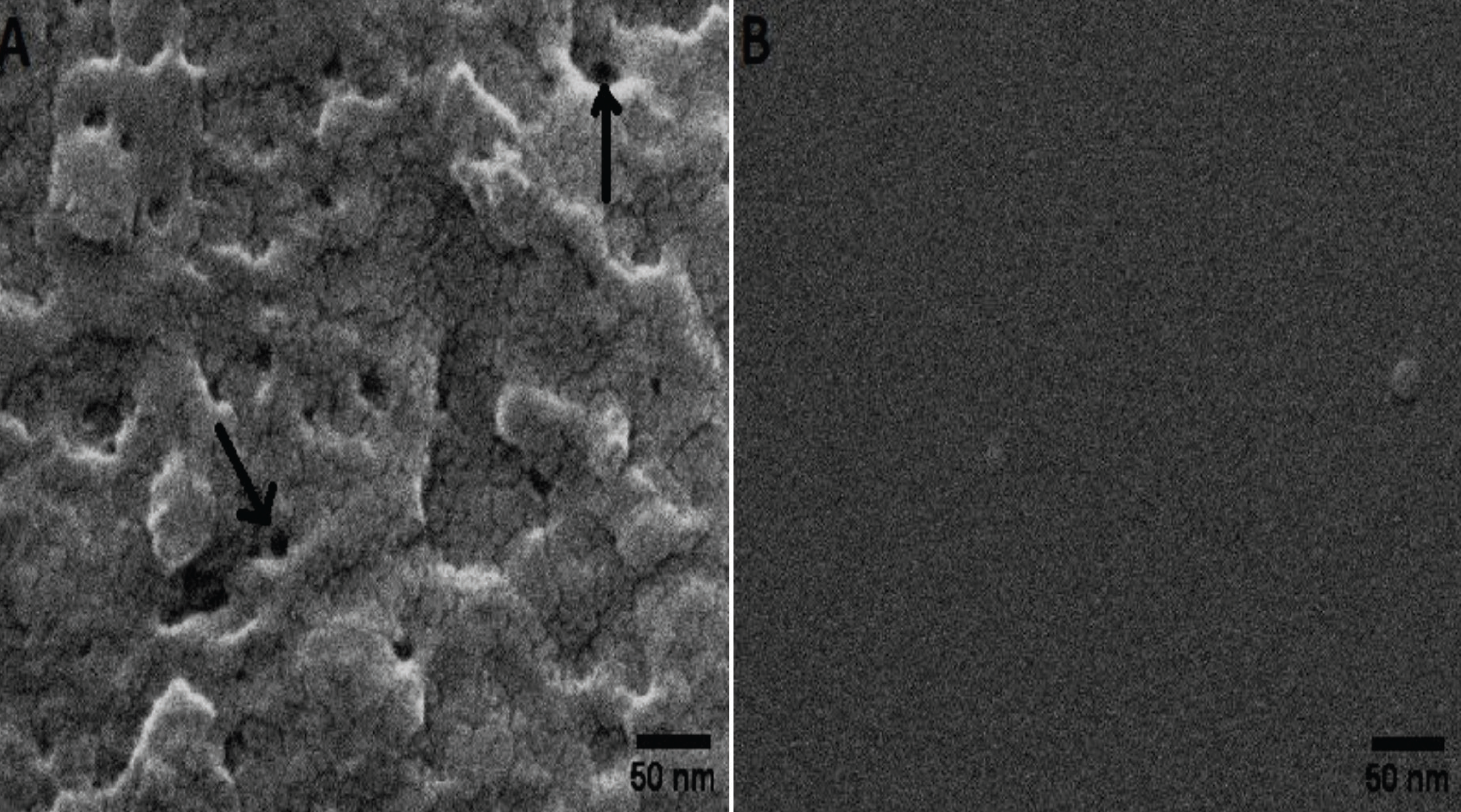 The Effects of Microseconds Electroporation on Pore Size, Viability and ...