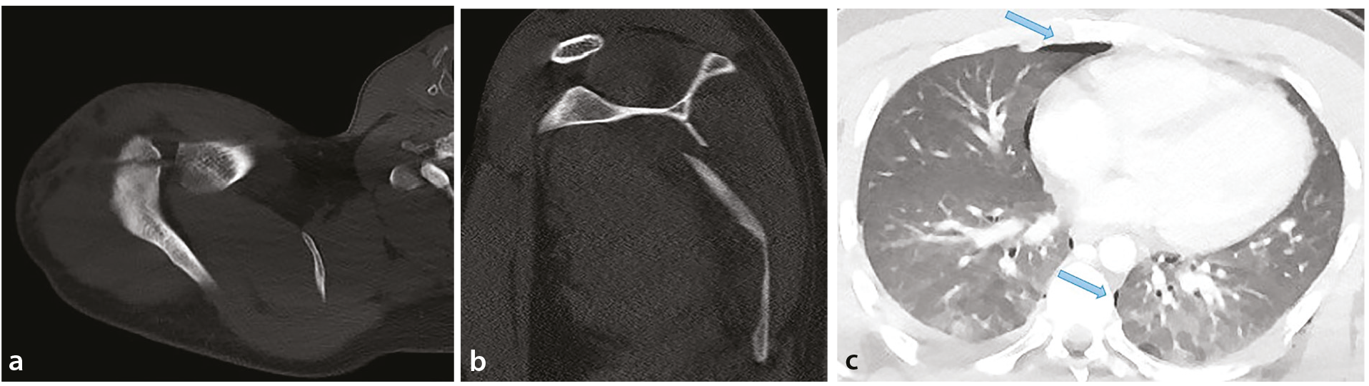Ota va qiz jinsiy aloqa Anal orgazm porno toifasi
