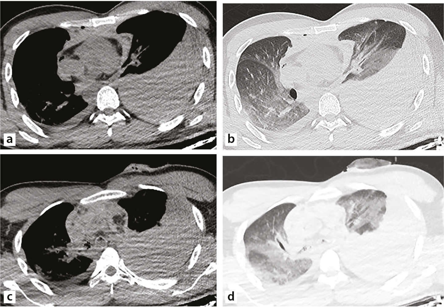 Talaba shaxsiy fotosurati Juda sexy va yalangoch qoramagiz